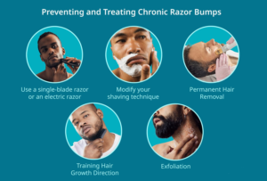 How to Get Rid of Razor Bumps