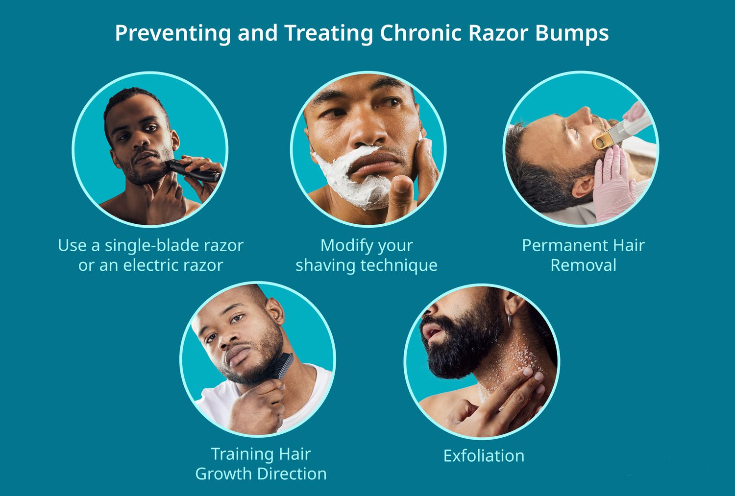 How to Get Rid of Razor Bumps